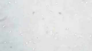 Soi tinh trùng chú bộ đội