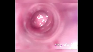 Sounding camera - up my dick