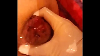 1298 fisting porn videos